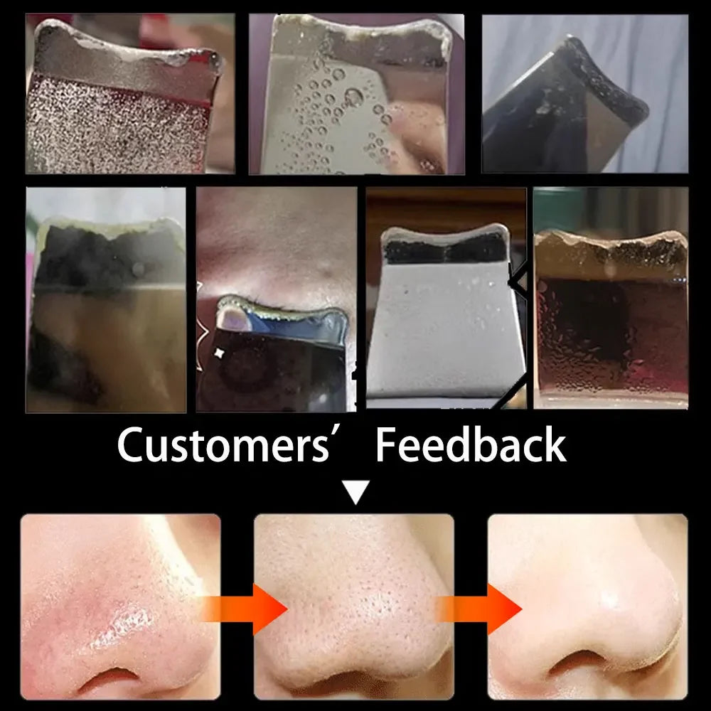 Ultrasonic Skin Scraper Pore Deep Face Cleaning