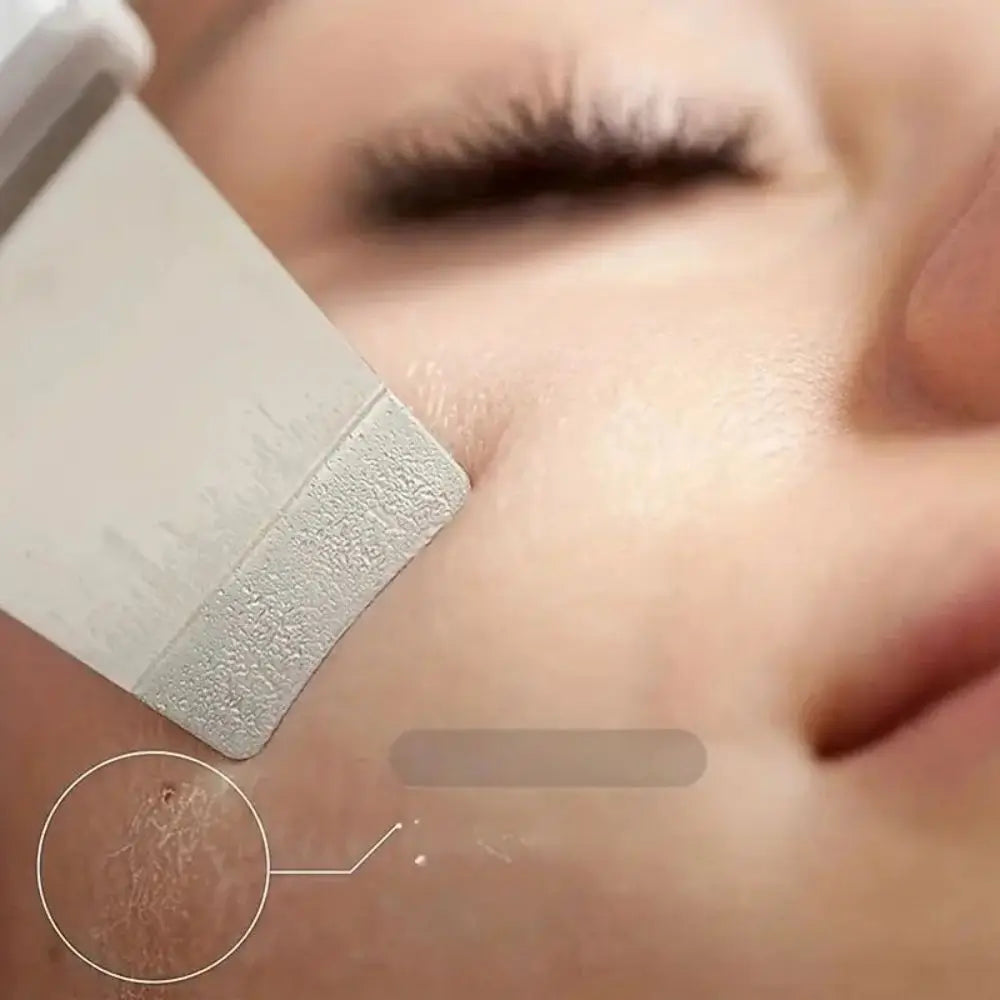 Ultrasonic Skin Scraper Pore Deep Face Cleaning